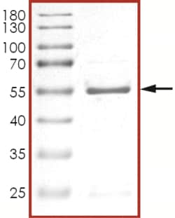 Sino Biological&nbsp;Recombinant Human EIF2AK4/GCN2 Protein (GST Tag)